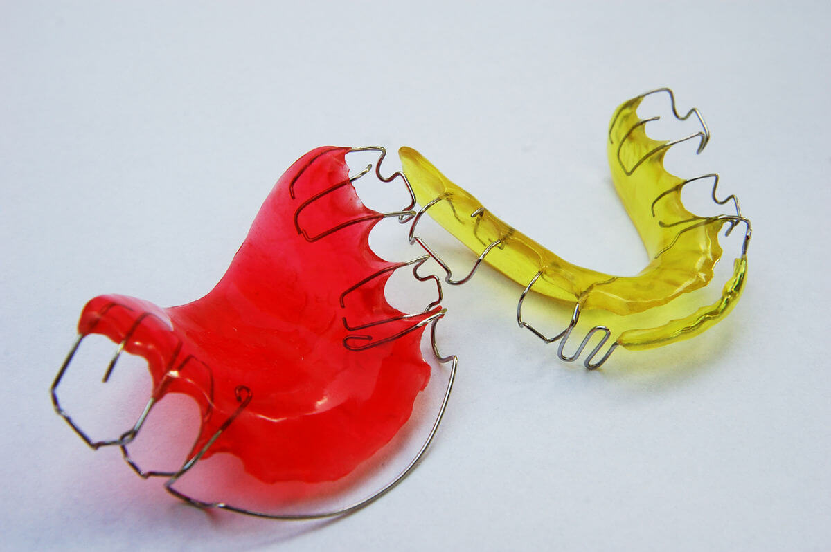 How Long Should Patients Wear Their Retainers Post-Ortho?