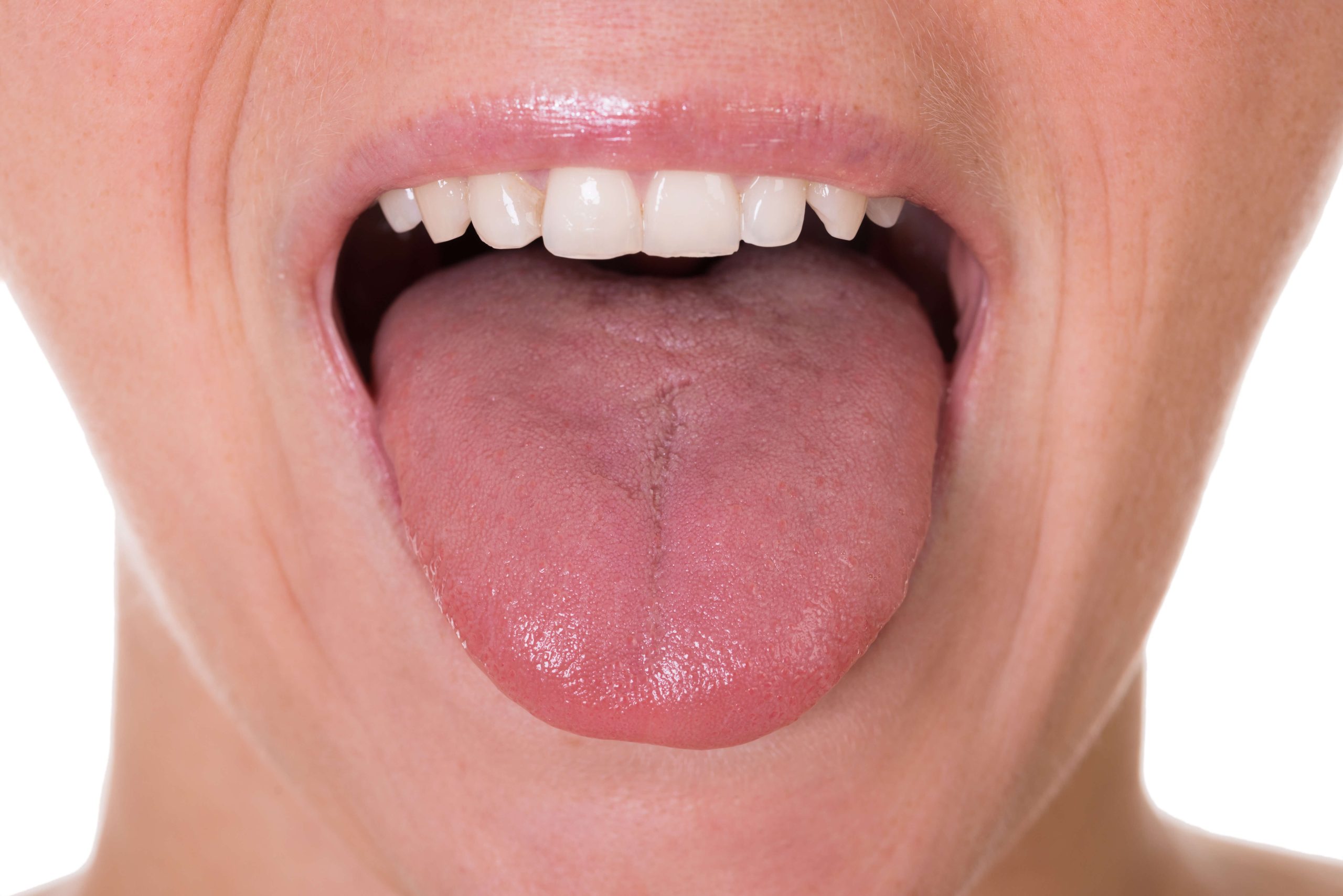 Tongue Function & Health Issues: Part 1