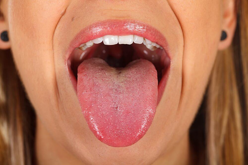 Tongue Position & Nose Breathing