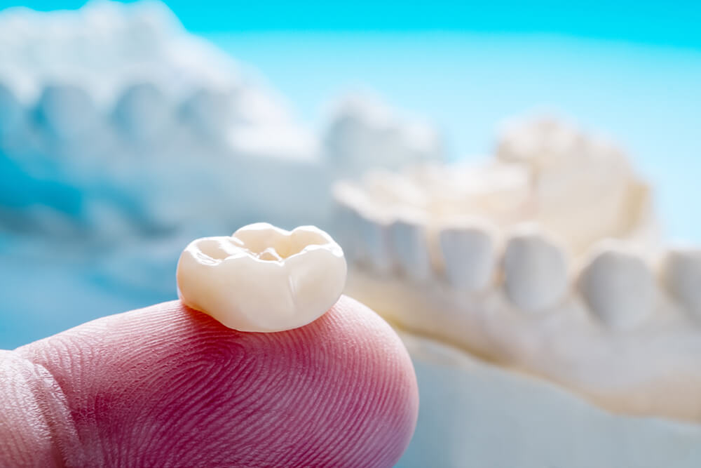 2 Transformative Tips to Leverage Phased Therapy for Single Tooth Dentistry