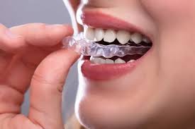 Why Use an Essix Retainer Versus a Flipper During Dental Implant Therapy