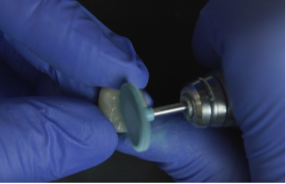 ivcolarpic3 - The Pankey Institute