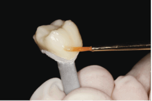 ivcolarpic4 - The Pankey Institute
